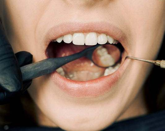 What Causes Gum Irritation?